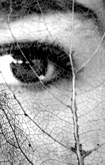 
Eye 1